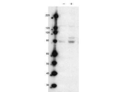 Western Blot: MARK2 [p Thr595] Antibody [NBP1-78028] - Lane 1: wild type Jurkat cells. Lane 2: wild type Jurkat cells stimulated with CD3/CD28 (T-cell receptor stimulation). Load: 35 ug per lane. Used at a dilution of 1:500 for overnight at 4C.